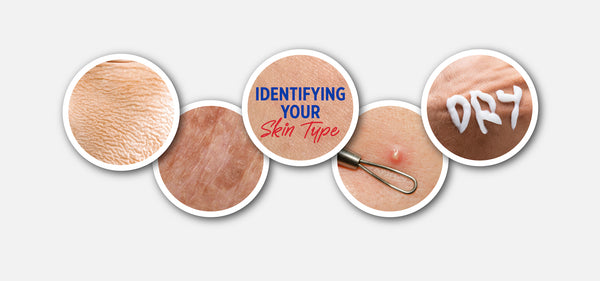 Identifying Your Skin Type